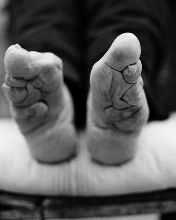 天下摄影网 - 历史残云中国最后的裹足女